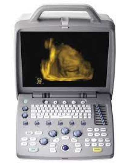 siui ultrasound scanner cts8800 plus sale