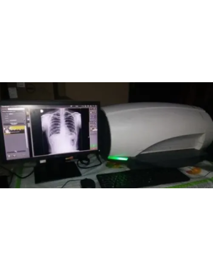 carestream vita 25 digital cr system sale