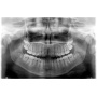 carestream kodak 9000c 3d cone beam cephalometric panoramic x ray sale